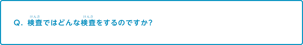 検査ラインではどんなことを検査するのですか？